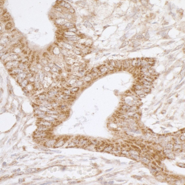 TRAP1/HSP75 Antibody in Immunohistochemistry (IHC)