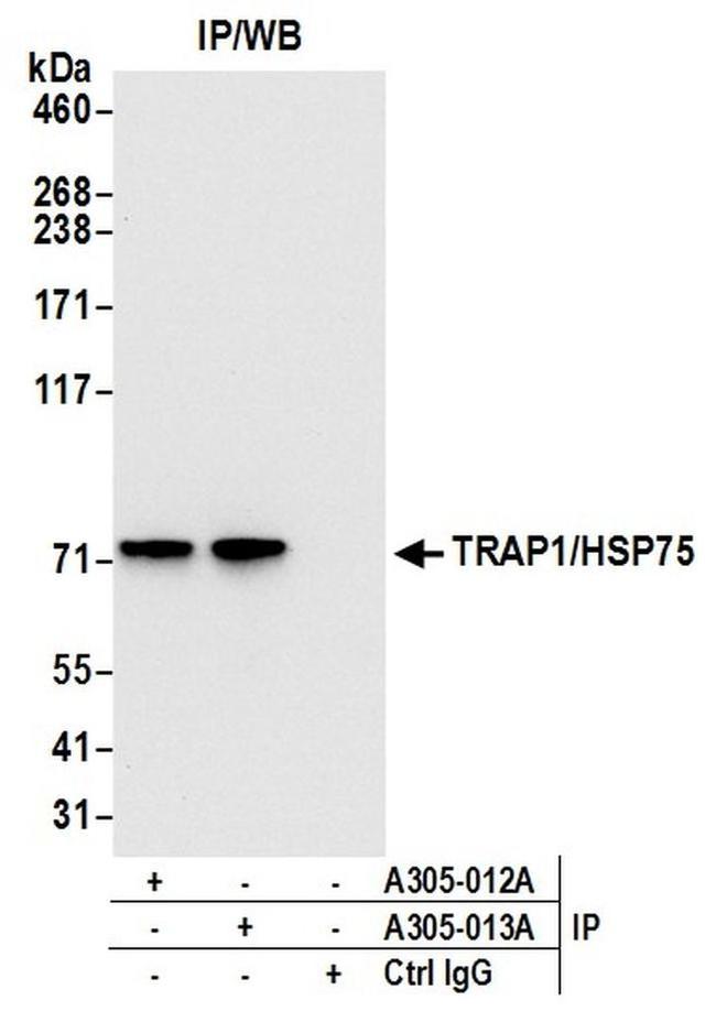 TRAP1/HSP75 Antibody in Western Blot (WB)