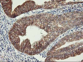 TRAP1 Antibody in Immunohistochemistry (Paraffin) (IHC (P))