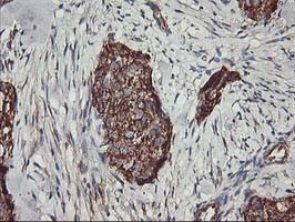 TRAP1 Antibody in Immunohistochemistry (Paraffin) (IHC (P))