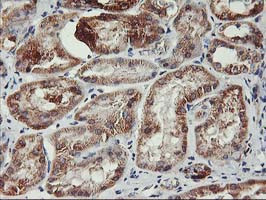 TRAP1 Antibody in Immunohistochemistry (Paraffin) (IHC (P))