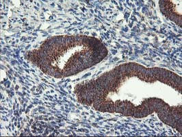 TRAP1 Antibody in Immunohistochemistry (Paraffin) (IHC (P))