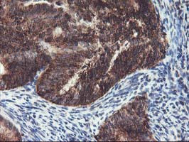 TRAP1 Antibody in Immunohistochemistry (Paraffin) (IHC (P))