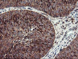 TRAP1 Antibody in Immunohistochemistry (Paraffin) (IHC (P))