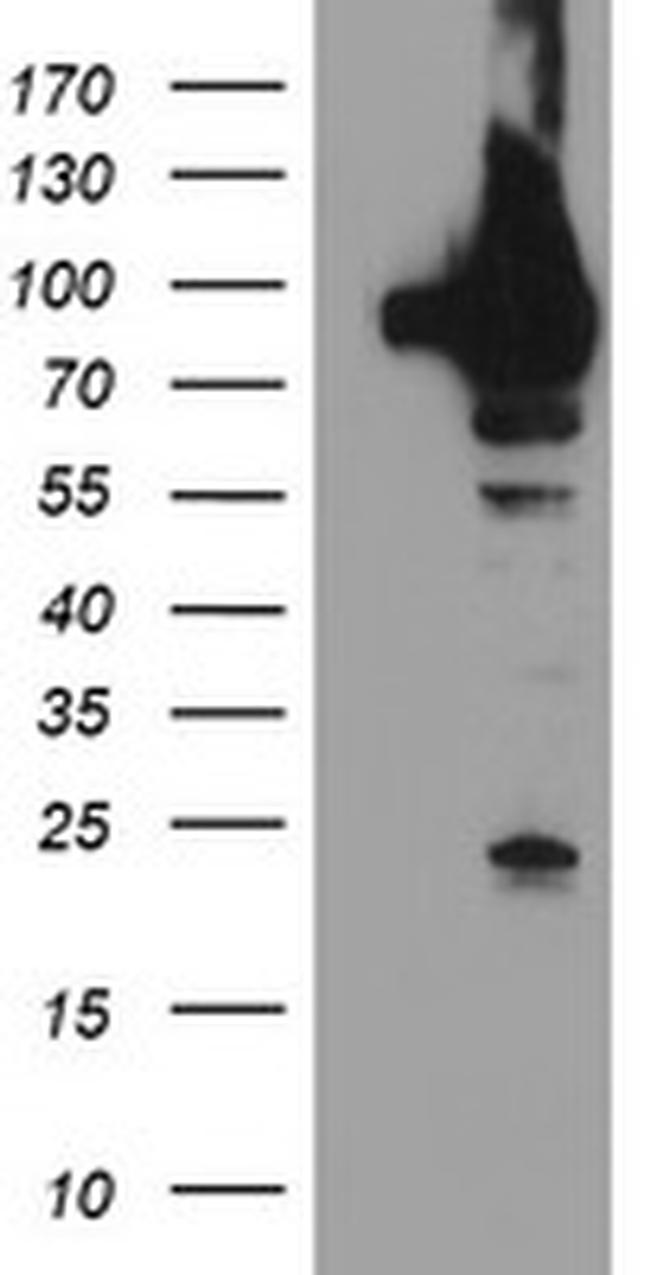 TRAP1 Antibody in Western Blot (WB)