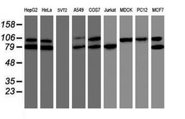 TRAP1 Antibody in Western Blot (WB)