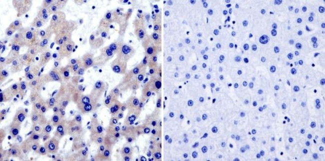 TRAP1 Antibody in Immunohistochemistry (Paraffin) (IHC (P))