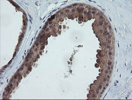 TRAPPC4 Antibody in Immunohistochemistry (Paraffin) (IHC (P))