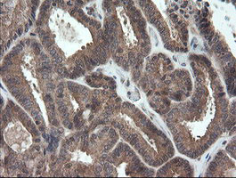 TRAPPC4 Antibody in Immunohistochemistry (Paraffin) (IHC (P))