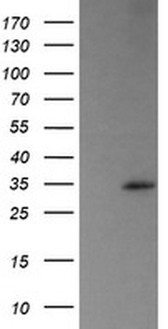 TRAPPC4 Antibody in Western Blot (WB)