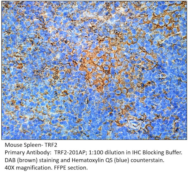 TRF2 Antibody in Immunohistochemistry (IHC)