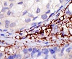 RNF216 Antibody in Immunohistochemistry (IHC)