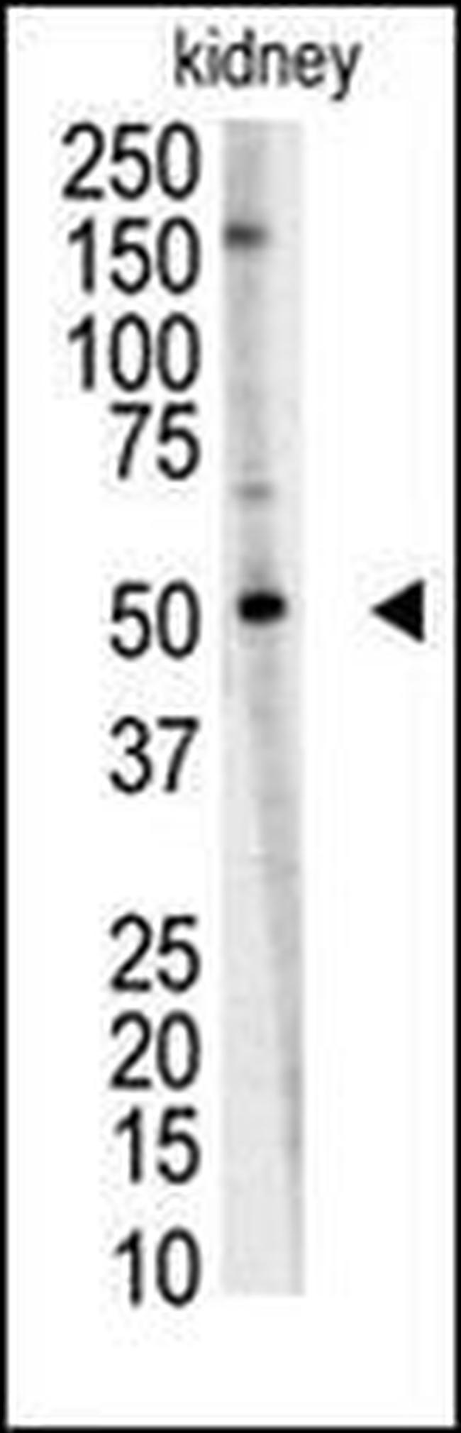 RNF216 Antibody in Western Blot (WB)