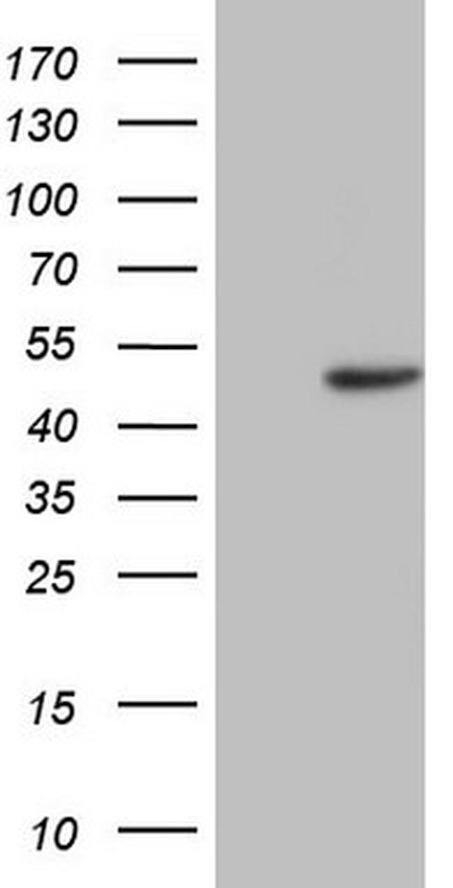 TRIB1 Antibody in Western Blot (WB)