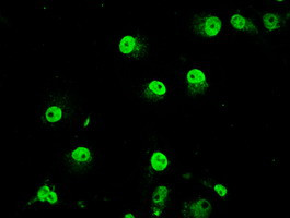 TRIB2 Antibody in Immunocytochemistry (ICC/IF)