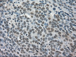 TRIB2 Antibody in Immunohistochemistry (Paraffin) (IHC (P))