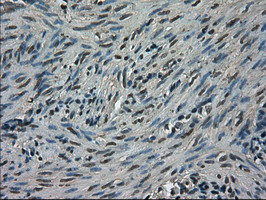 TRIB2 Antibody in Immunohistochemistry (Paraffin) (IHC (P))