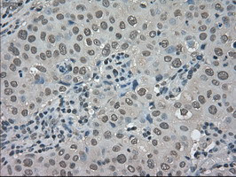 TRIB2 Antibody in Immunohistochemistry (Paraffin) (IHC (P))