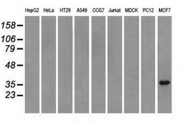 TRIB2 Antibody in Western Blot (WB)