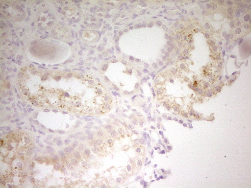 TRIB3 Antibody in Immunohistochemistry (Paraffin) (IHC (P))