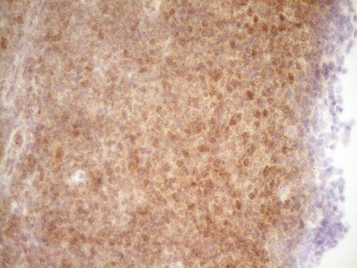 TRIB3 Antibody in Immunohistochemistry (Paraffin) (IHC (P))