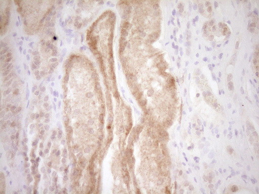 TRIB3 Antibody in Immunohistochemistry (Paraffin) (IHC (P))