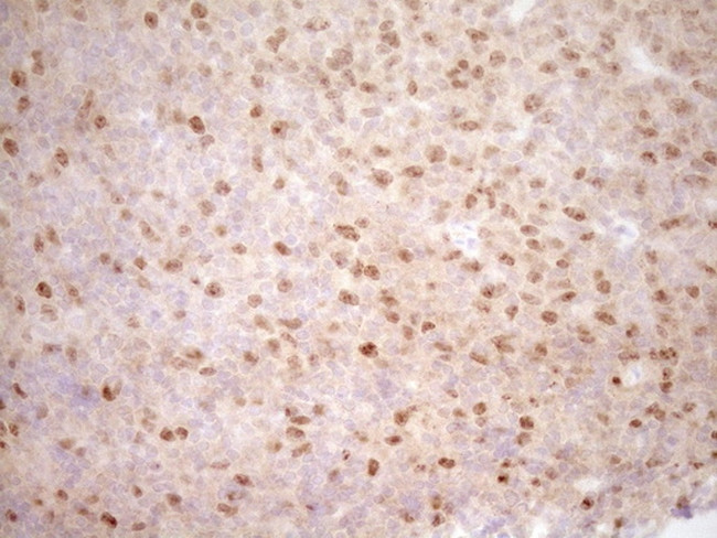 TRIB3 Antibody in Immunohistochemistry (Paraffin) (IHC (P))