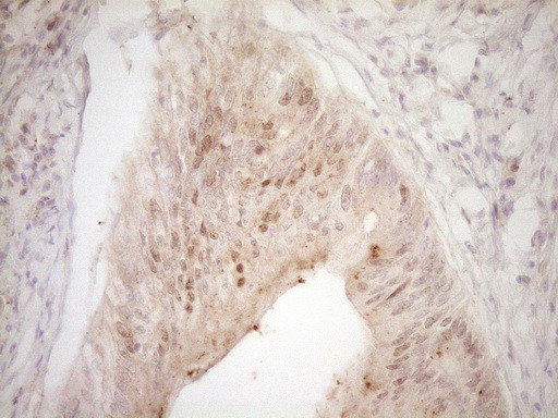 TRIB3 Antibody in Immunohistochemistry (Paraffin) (IHC (P))