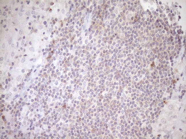 TRIB3 Antibody in Immunohistochemistry (Paraffin) (IHC (P))