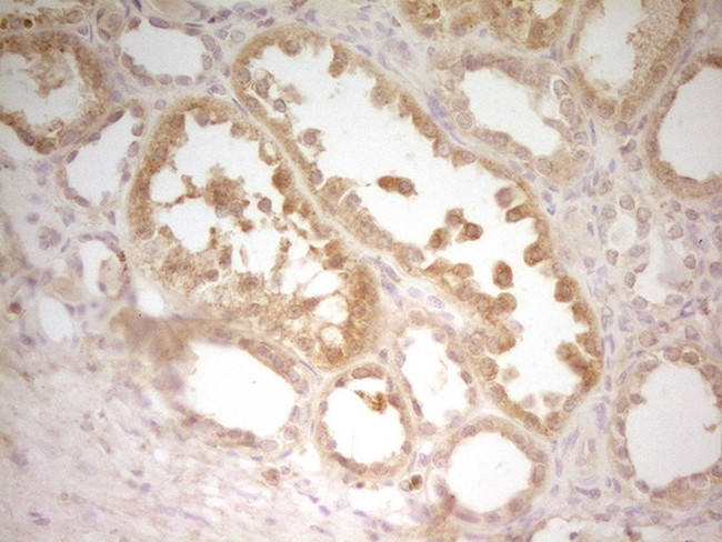 TRIB3 Antibody in Immunohistochemistry (Paraffin) (IHC (P))