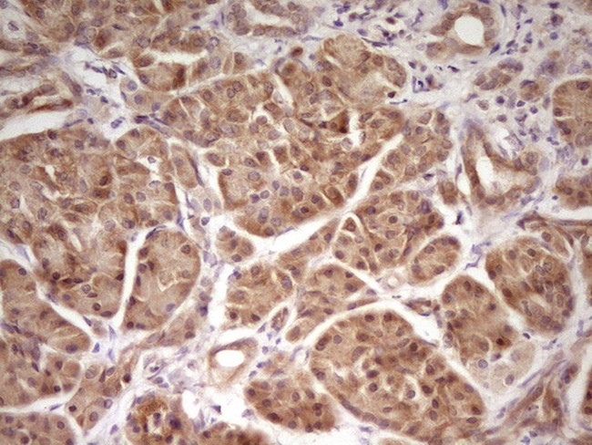 TRIB3 Antibody in Immunohistochemistry (Paraffin) (IHC (P))