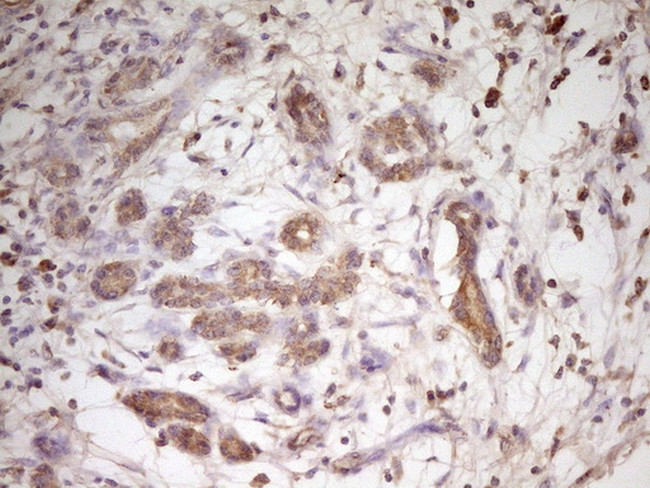 TRIB3 Antibody in Immunohistochemistry (Paraffin) (IHC (P))