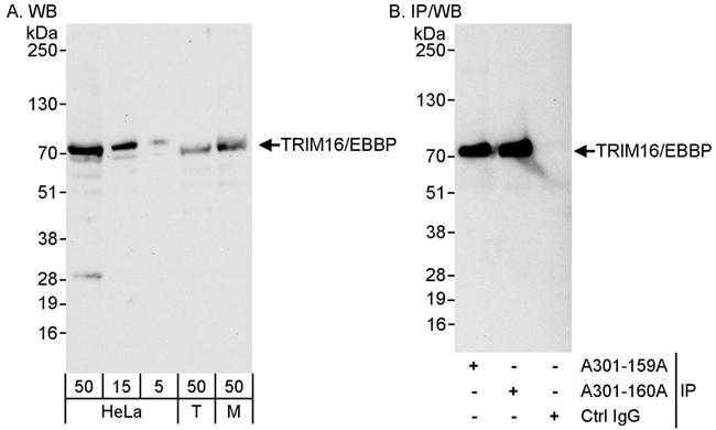 TRIM16/EBBP Antibody in Western Blot (WB)