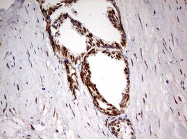 TRIM24 Antibody in Immunohistochemistry (Paraffin) (IHC (P))