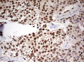 TRIM24 Antibody in Immunohistochemistry (Paraffin) (IHC (P))