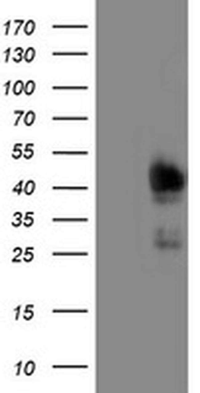 TRIM24 Antibody in Western Blot (WB)