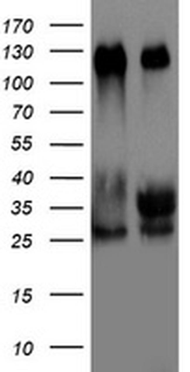 TRIM24 Antibody in Western Blot (WB)