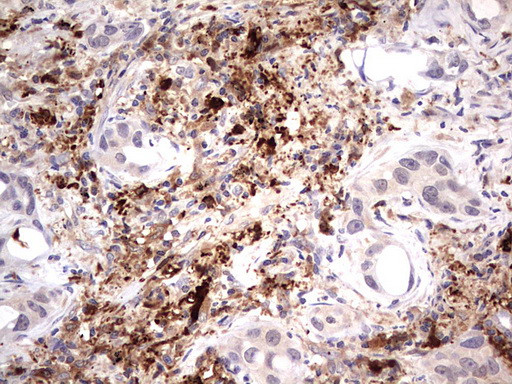 TRIM27 Antibody in Immunohistochemistry (Paraffin) (IHC (P))