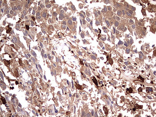 TRIM27 Antibody in Immunohistochemistry (Paraffin) (IHC (P))