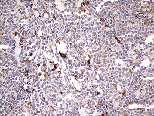 TRIM27 Antibody in Immunohistochemistry (Paraffin) (IHC (P))