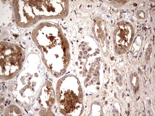 TRIM27 Antibody in Immunohistochemistry (Paraffin) (IHC (P))