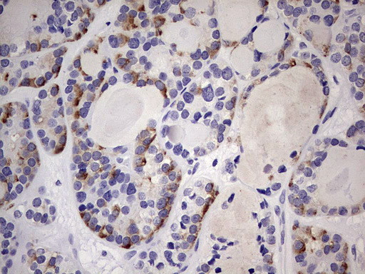 TRIM27 Antibody in Immunohistochemistry (Paraffin) (IHC (P))