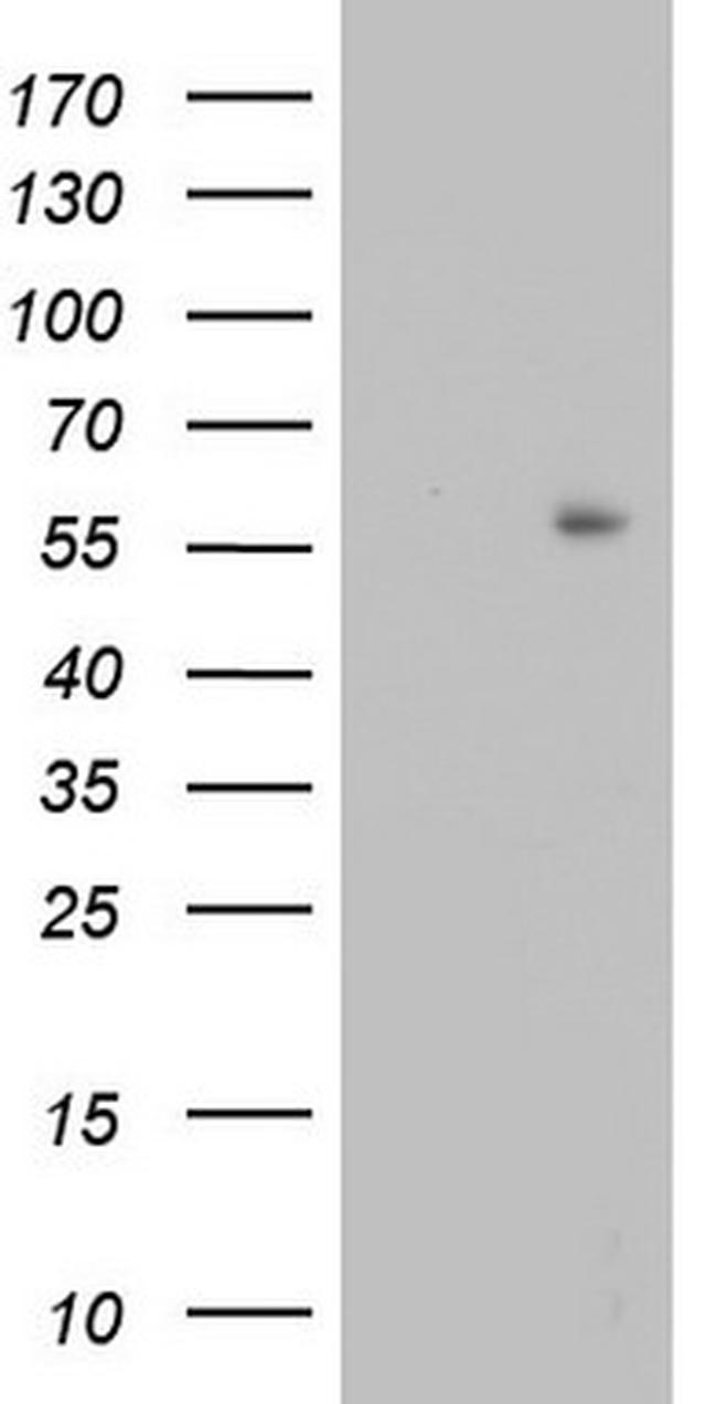 TRIM27 Antibody in Western Blot (WB)