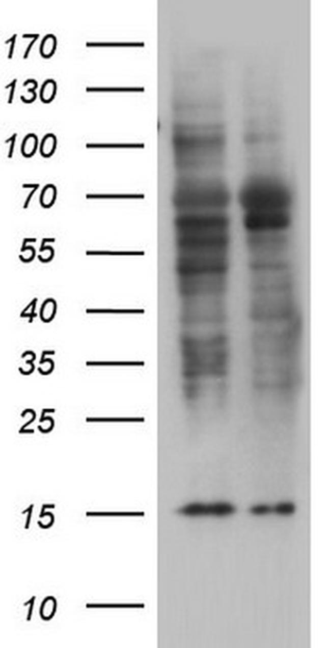 TRIM27 Antibody in Western Blot (WB)