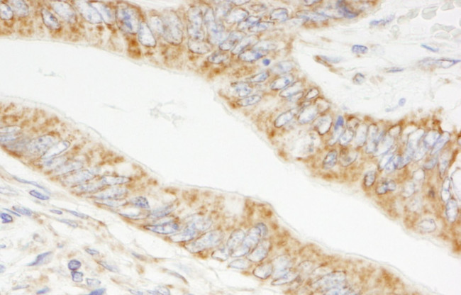 TRIM3/BERP Antibody in Immunohistochemistry (IHC)