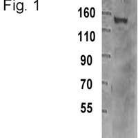 TRIM33 Antibody in Western Blot (WB)