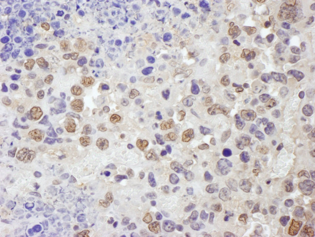 TRIM33/TIF1gamma Antibody in Immunohistochemistry (IHC)