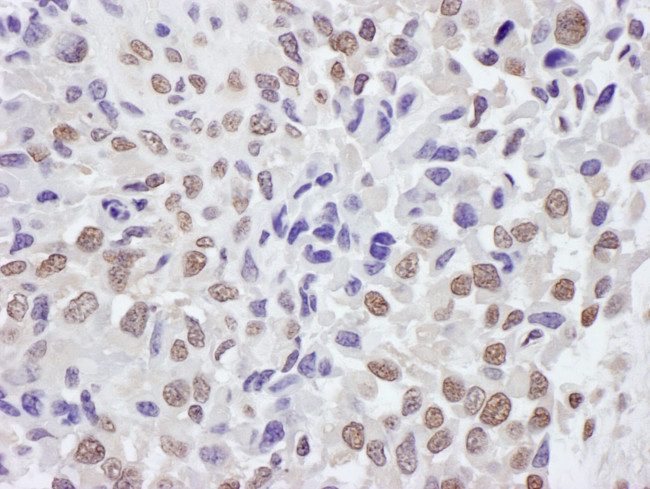 TRIM33/TIF1gamma Antibody in Immunohistochemistry (IHC)