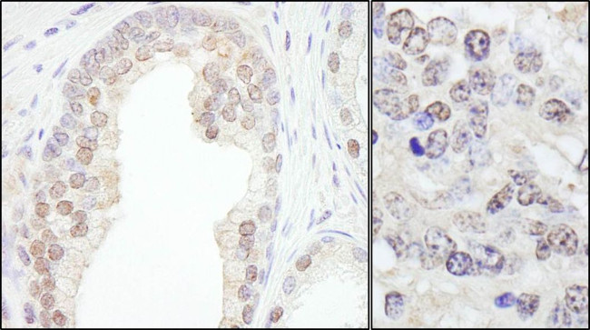 TRIM33/TIF1gamma Antibody in Immunohistochemistry (IHC)