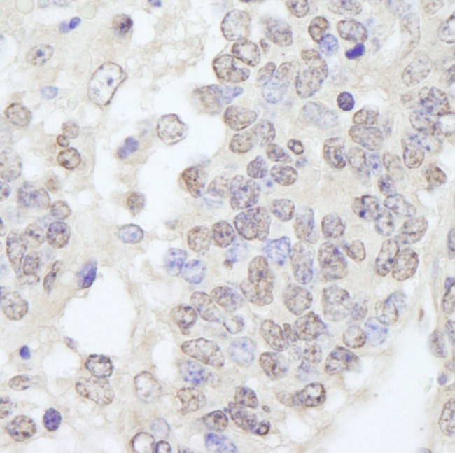 TRIM33/TIF1gamma Antibody in Immunohistochemistry (IHC)